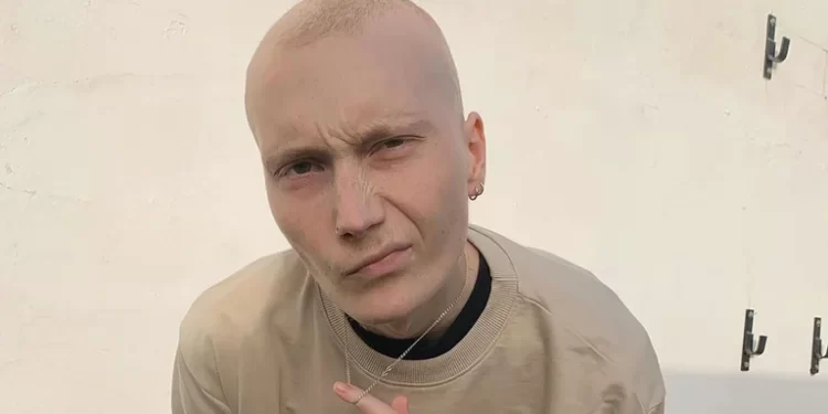 Murió Charlie, el famoso tiktoker español que contaba cómo era vivir con cáncer