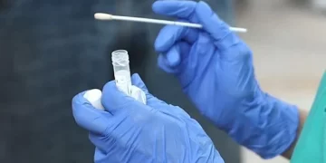 Reportan 479 nuevos casos de COVID-19; la tasa de positividad diaria se sitúa en 21.91%