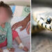 Con mordidas, niña mata a serpiente que la atacó