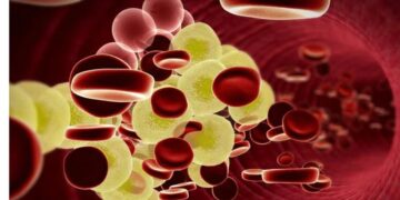 Triglicéridos y colesterol: cuáles son los niveles altos y cómo bajarlos para evitar enfermedades cardíacas