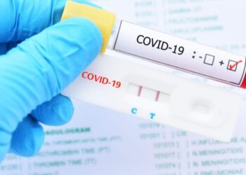 Reportan 26 nuevos casos de COVID-19