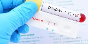 Reportan 26 nuevos casos de COVID-19