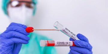 Salud Pública registra 263 casos activos de COVID-19 y 39 nuevos casos