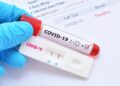 Mil 728 casos de Covid-19 activos registra el país