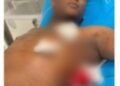 Muere supuesto asaltante herido en intercambio de disparos con miembros de la P.N. en Higüey