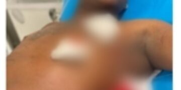 Muere supuesto asaltante herido en intercambio de disparos con miembros de la P.N. en Higüey