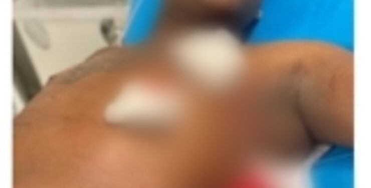 Muere supuesto asaltante herido en intercambio de disparos con miembros de la P.N. en Higüey