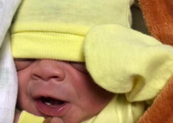 Bebé nace con un diente en hospital de Cotuí