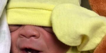 Bebé nace con un diente en hospital de Cotuí