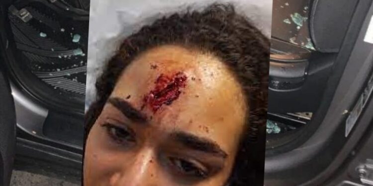 PN asume investigaciones de la joven agredida por limpiavidrios