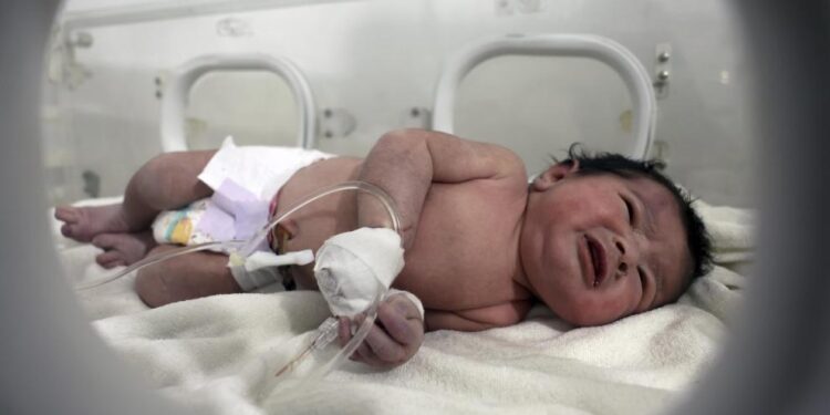 Director del hospital acoge en su casa a Aya, la 'bebé milagro' del terremoto de Siria