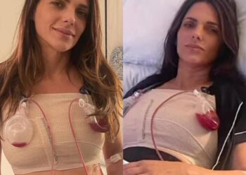 Síndrome de Asia, la rara enfermedad que afectó a la periodista Bárbara Bermudo