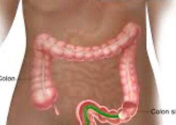 Instituto Dominicano de Gastroenterología realizará seminario sobre prevención de cáncer de colon