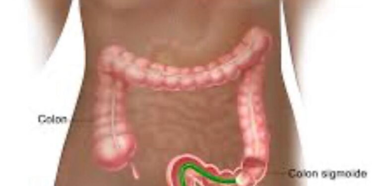 Instituto Dominicano de Gastroenterología realizará seminario sobre prevención de cáncer de colon