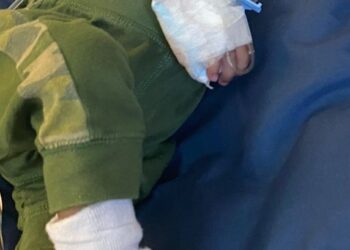 FAMILIA PIDE AYUDA PARA URGENTE CIRUGÍA A NIÑO