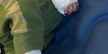 FAMILIA PIDE AYUDA PARA URGENTE CIRUGÍA A NIÑO