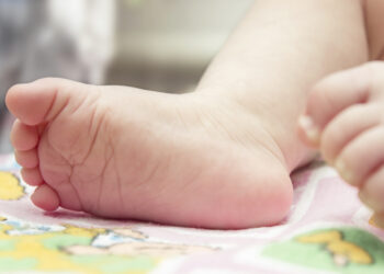 SNS aclara cinco neonatos murieron en febrero por infección, en Maternidad Los Mina