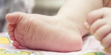 SNS aclara cinco neonatos murieron en febrero por infección, en Maternidad Los Mina