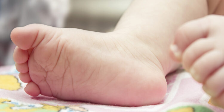 SNS aclara cinco neonatos murieron en febrero por infección, en Maternidad Los Mina