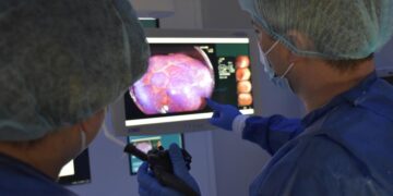 Un nuevo fármaco reduce un 68% el riesgo de progresión en cáncer de colon metastásico