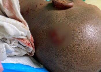 PN apresa “limpiavidrios” por agresión a camarógrafo de Noticentro