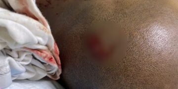 PN apresa “limpiavidrios” por agresión a camarógrafo de Noticentro