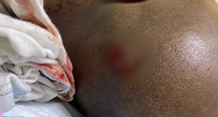 PN apresa “limpiavidrios” por agresión a camarógrafo de Noticentro