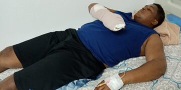 Haitianos hieren y despojan de escopeta a miembro de la FARD asignado a CESFronT