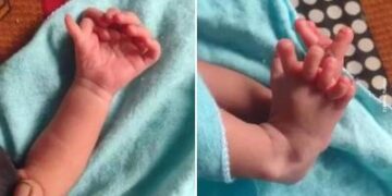 Bebé nace con 26 dedos en India y padres creen que es reencarnación de una Deidad