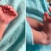 Bebé nace con 26 dedos en India y padres creen que es reencarnación de una Deidad