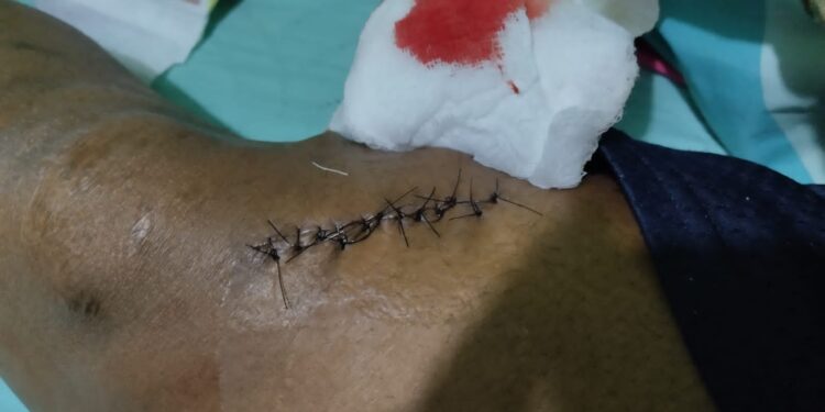 Atentan contra candidato a regidor del PLD Marcos Rosario; apuñalan su seguridad