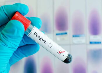 SNS informa continúa reducción casos dengue; 82 ingresos en SD en las últimas 24 horas