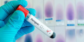 SNS informa continúa reducción casos dengue; 82 ingresos en SD en las últimas 24 horas