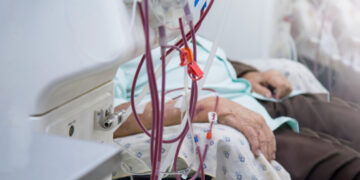 Pacientes dependen de diálisis y fármaco costoso para vivir