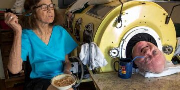 Muere Paul Alexander, hombre que vivió 70 años en un pulmón de acero