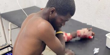 Haitianos atracan y le propinan machetazo a paisano