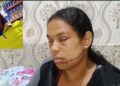 PN captura hombre activamente buscado tras ocasionarle heridas en el rostro a su expareja