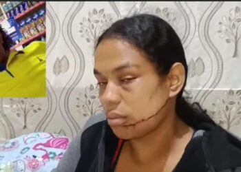 PN captura hombre activamente buscado tras ocasionarle heridas en el rostro a su expareja