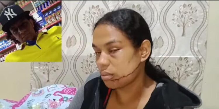 PN captura hombre activamente buscado tras ocasionarle heridas en el rostro a su expareja