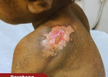 Autoridades policiales rescatan niña de 5 años que nacionales  haitianos tenían en cautiverio