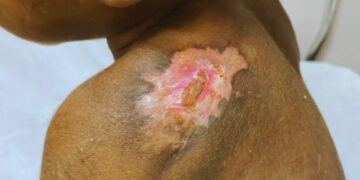 Autoridades policiales rescatan niña de 5 años que nacionales  haitianos tenían en cautiverio