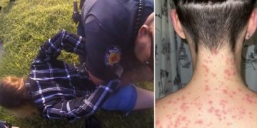 Mujer denuncia Policía de Texas puso su cara sobre hormigas rojas durante arresto