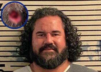 Hombre muerde en la cabeza a un policía en Florida