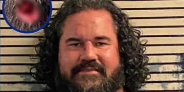 Hombre muerde en la cabeza a un policía en Florida