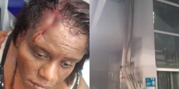 Viga de estación del Metro se desprende y hiere en la cabeza a una mujer