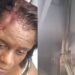 Viga de estación del Metro se desprende y hiere en la cabeza a una mujer