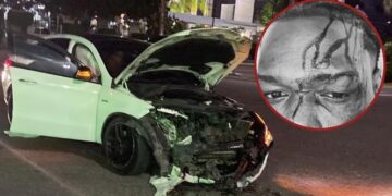 Hospitalizan a Ceky Viciny tras sufrir accidente de tránsito