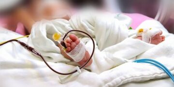 TC falla contra padres que se negaban a permitir transfusión de sangre a bebé por religión