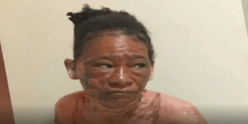 Mujer quema a otra tras lanzarle agua caliente en Barahona