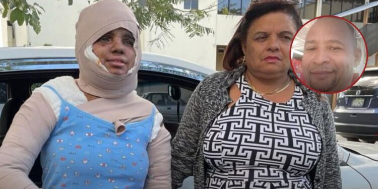 Capturan en El Seibo a hombre buscado por rociar aceite caliente a expareja